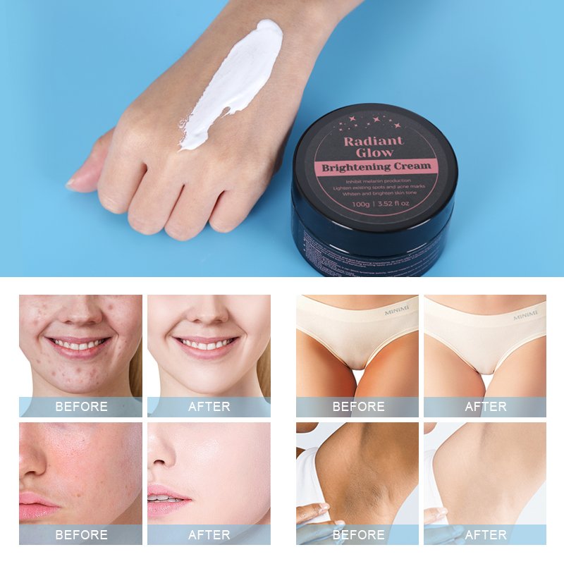 Skin Whitening Cream - 6